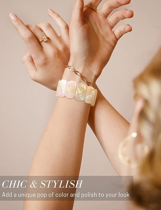 White Tortoise Resin Cute Apple Watch Band (Elastic)